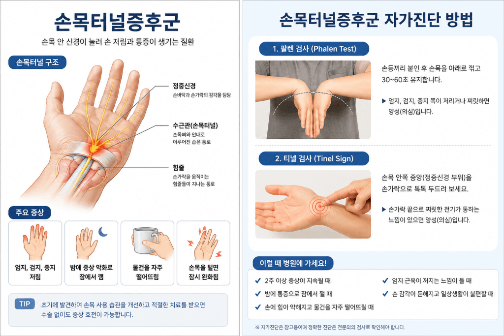 손목터널증후군