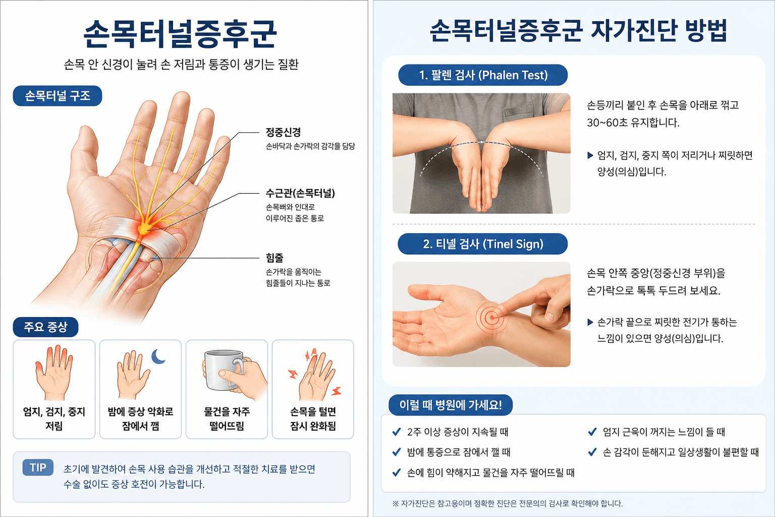 손목터널증후군